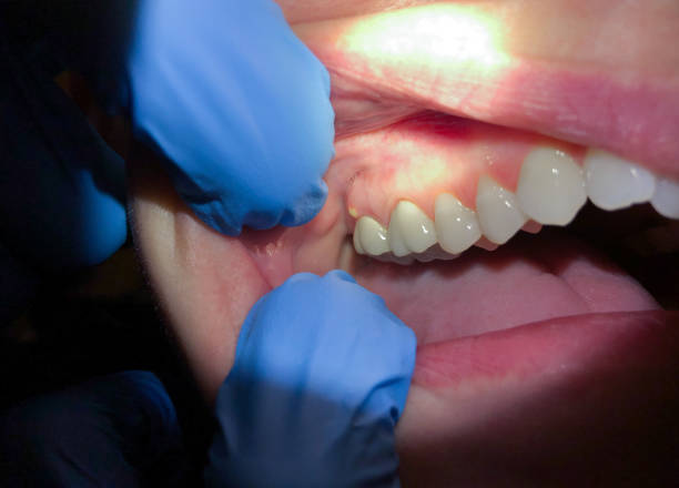 Best Emergency Treatment for Toothache in Kempner, TX